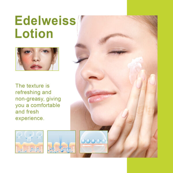 Edelweiss Lotion, Moisturizing And Brightening Face Dull And Shiny Skin Moisturizing Lotion - Image 5