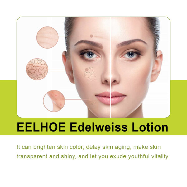 Edelweiss Lotion, Moisturizing And Brightening Face Dull And Shiny Skin Moisturizing Lotion - Image 4